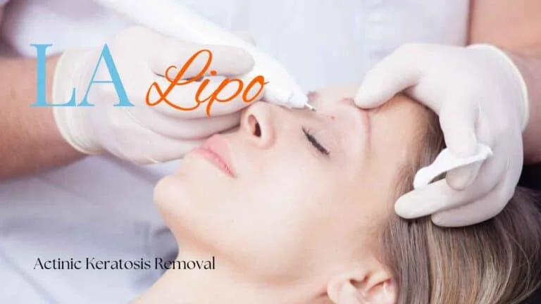 Woman receiving Actinic Keratosis Removal Treatment Romsey