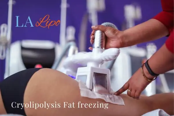 women getting fat freezing Romsey
