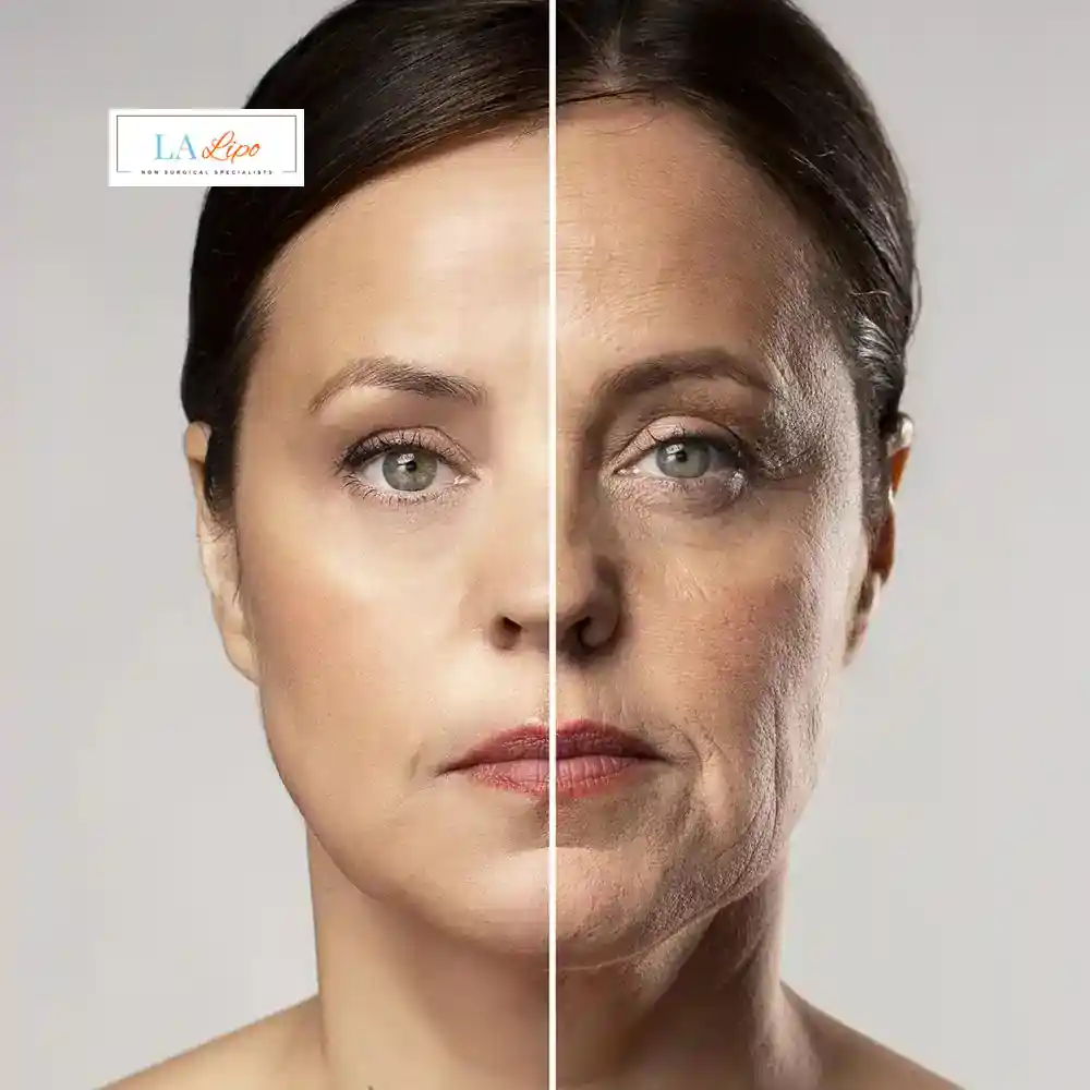 How Can You Tell If Non-Surgical Skin Tightening Is Right for You Romsey?