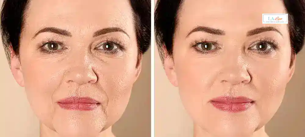 Why Aren’t My Skincare Products Making My Sagging Skin Look Firmer Romsey?