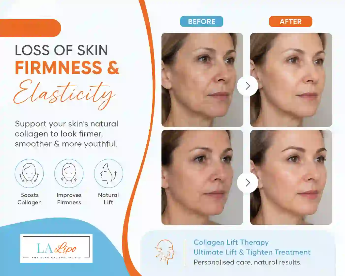 Sign #7: Loss of Skin Firmness and Elasticity Romsey