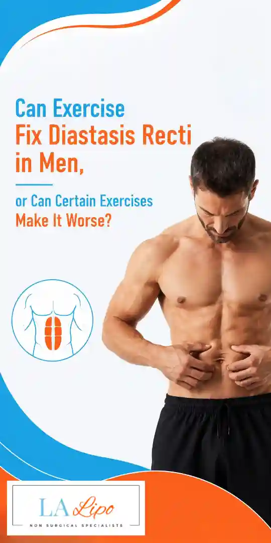 Can Exercise Fix Diastasis Recti in Men, or Can Certain Exercises Make It Worse Romsey?